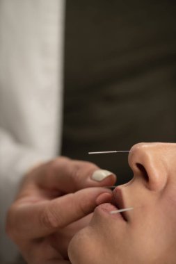 Acupuncturist inserting acupuncture needles into female patient nose to help quit smoking clipart