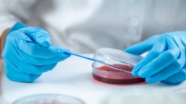 Mikrobiyolog araştırma laboratuarında petri kabında kan aromasını aşıladı..