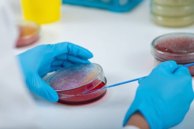 Mikrobiyolog araştırma laboratuarında petri kabında kan aromasını aşıladı..