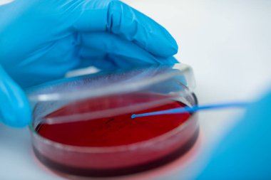 Mikrobiyolog, biyomedikal laboratuvarda araştırma yapmak için petri kabında kan tarımı aşıladı..
