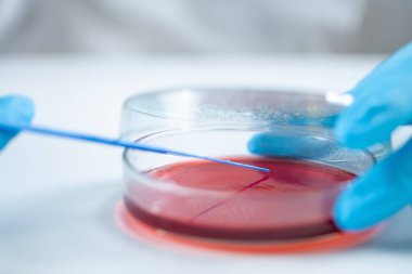 Mikrobiyolog, biyomedikal laboratuvarda araştırma yapmak için petri kabında kan tarımı aşıladı..