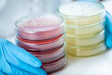 Mikrobiyologlar, laboratuvar analizi için bakteri kültürlerini barındıran petri kaplarıyla dolu bankta oturuyorlar..