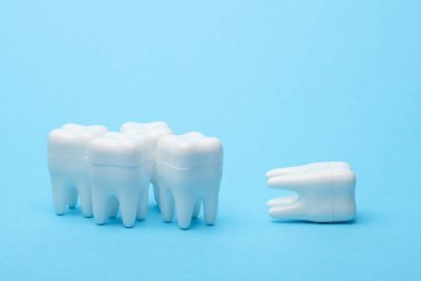 Mavi arka planda plastik diş modelleri