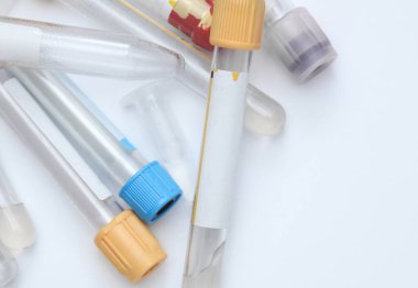 Beyaz Arkaplanda Çeşitli Boş Tıbbi Laboratuvar Test Tüpleri