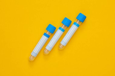 Sarı arka planda tıbbi boş kan tüpleri.