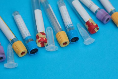 Mavi Arkaplanda Çeşitli Boş Tıbbi Laboratuvar Test Tüpleri