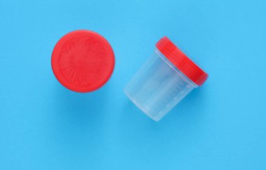 Mavi arka planda idrar testi kavanozu