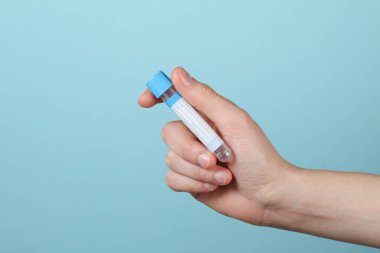 Mavi arka planda el ele tutuşan boş kan testi tüpü