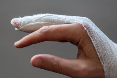 Tokmak parmağı, orta parmakla sabitleme bandajı, eklem travmasının ardından son falanks hareketsiz hale getirmek için.