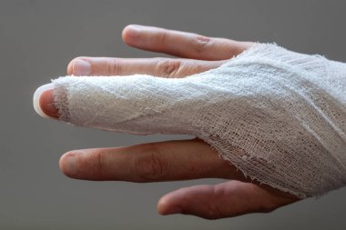 Tokmak parmağı, orta parmakla sabitleme bandajı, eklem travmasının ardından son falanks hareketsiz hale getirmek için.