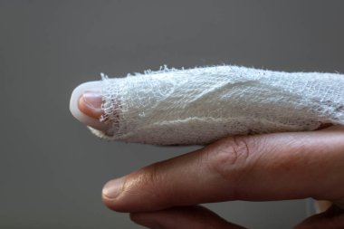 Tokmak parmağı, orta parmakla sabitleme bandajı, eklem travmasının ardından son falanks hareketsiz hale getirmek için.