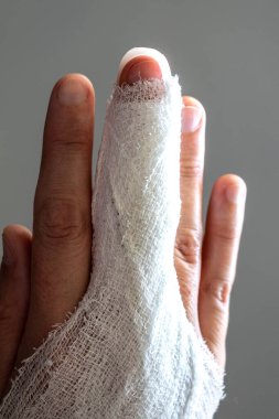 Tokmak parmağı, orta parmakla sabitleme bandajı, eklem travmasının ardından son falanks hareketsiz hale getirmek için.