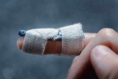 Eklem travmasının ardından son falanksı hareketsiz kılmak için orta parmağında özel ortozu olan çekiç parmağı.