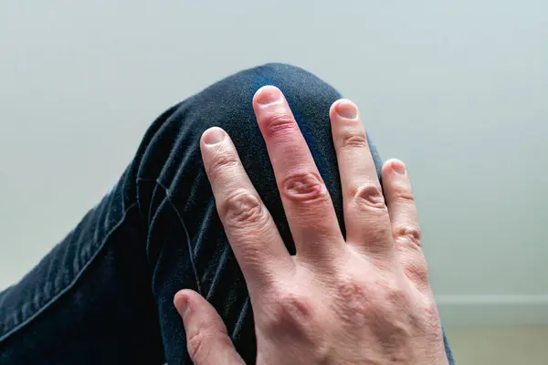 Eklem travmasını takiben orta parmaktan alınan alçı parmak iyileşmesi.