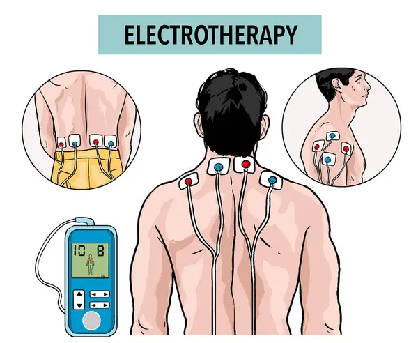 Fysiotherapie Rugpijn Verlichting Letselrehabilitatie Elektrotherapie Klinische Hulp Geïsoleerde Afbeelding Vector — Stockvector