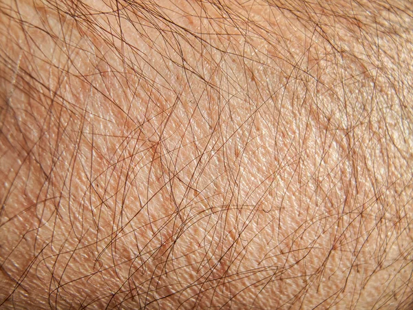 Human Skin Texture Man Arm Detail — Stock Photo, Image