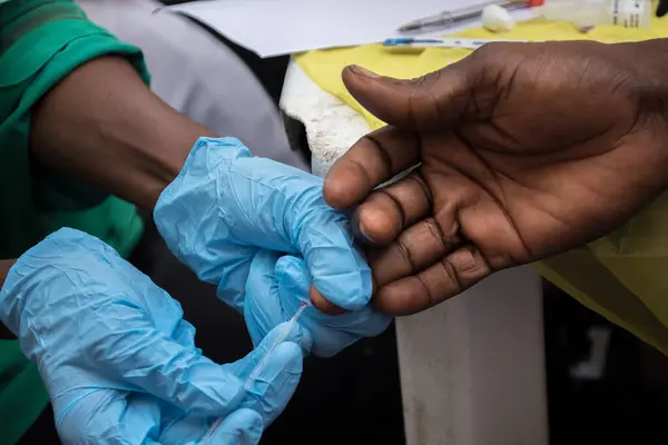 stock image Medical personnel take blood samples during a medical outreach organized by the Lagos Island Local Government Chairman. Lagos Nigeria on February 17, 2022.  