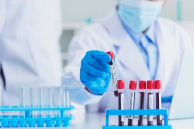 Bilim adamının elleri, kan testi tüpü laboratuarını tutuyor. Doktor klinik sağlık teknisyeni kan örneği teşhisini test ediyor. Ekin adam bilim adamı elleri tıbbi laboratuvarı test ediyor.