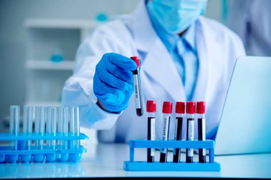 Doktor Kliniği 'nin sağlık teknisyeni kan örneği teşhisini test ediyor. Ekin adam bilim adamı elleri tıbbi laboratuvarı test ediyor. Bilim adamı elleri, örnek kan testi tüpü laboratuvarını tutuyor..