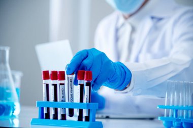 Scientist man holding sample blood test tube in science laboratory. Doctor clinic healthcare technician lab testing blood sample diagnosis. Asian man scientist working in hiv testing medical lab.