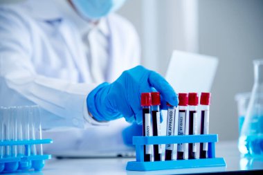 Bilim adamının elleri, kan testi tüpü laboratuarını tutuyor. Doktor klinik sağlık teknisyeni kan örneği teşhisini test ediyor. Ekin adam bilim adamı elleri tıbbi laboratuvarı test ediyor.