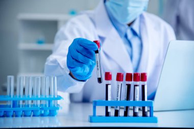 Doktor Kliniği 'nin sağlık teknisyeni kan örneği teşhisini test ediyor. Ekin adam bilim adamı elleri tıbbi laboratuvarı test ediyor. Bilim adamı elleri, örnek kan testi tüpü laboratuvarını tutuyor..