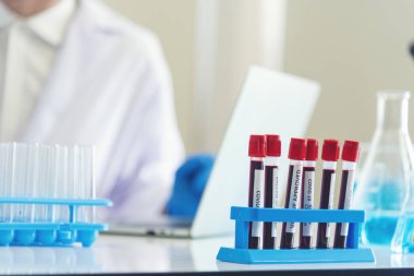 Laboratuvar arka planında bilim kimyası cam tüpleri var. Sıvı tüp biyoloji laboratuvarı kimyasal sıvı bilim adamı deney tüpleri tıbbi cam eşyalar. Kimya Bilimsel İlaç geçmişi