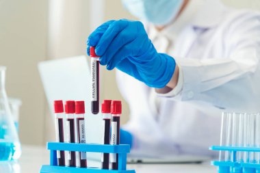 Bilim adamının elleri, kan testi tüpü laboratuarını tutuyor. Doktor klinik sağlık teknisyeni kan örneği teşhisini test ediyor. Ekin adam bilim adamı elleri tıbbi laboratuvarı test ediyor.