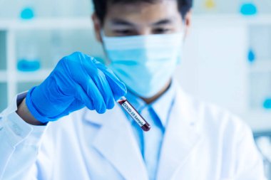 Scientist man holding sample blood test tube in science laboratory. Doctor clinic healthcare technician lab testing blood sample diagnosis. Asian man scientist working in hiv testing medical lab.