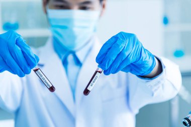 Bilim adamının elleri, kan testi tüpü laboratuarını tutuyor. Doktor klinik sağlık teknisyeni kan örneği teşhisini test ediyor. Ekin adam bilim adamı elleri tıbbi laboratuvarı test ediyor.