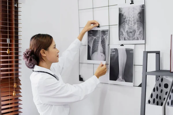 一名亚洲女医生在分析治疗症状前看病人肺部X光片的画像 — 图库照片
