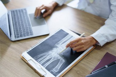 Asyalı kadın doktor röntgen filminde hasta verilerini analiz ediyor ve ameliyata hazırlanmadan önce bilgisayar kullanıyor..
