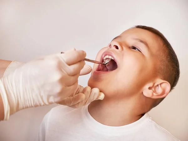 Child Teeth Examined Using Dental Mirror Royalty Free Stock Images