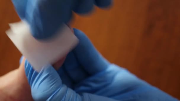Heilsalbe Wird Mit Der Warze Auf Den Finger Aufgetragen Behandlung — Stockvideo