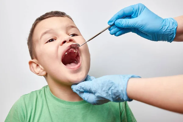 Examination Oral Cavity Boy Missing Milk Teeth Loss Milk Teeth Stock Image