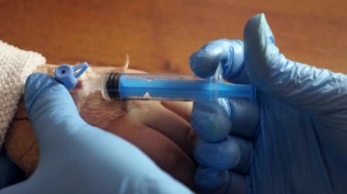 Doktor kolundaki kateterden çocuğa ilaç enjekte etmek için pompa kullanıyor..