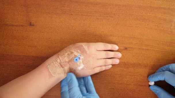 Doctor Uses Plunger Inject Boy Medicine Catheter His Arm — Stock Video