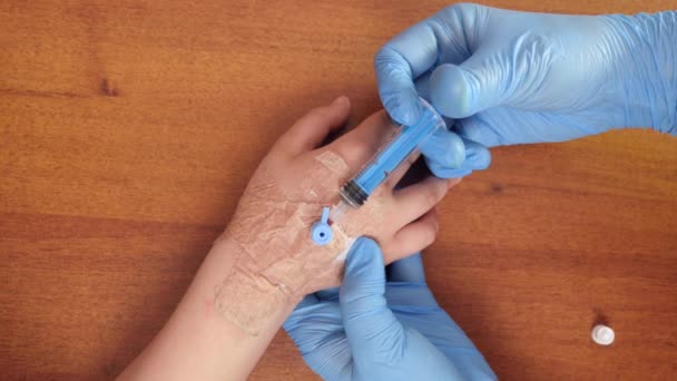 Doktor Kolundaki Kateterden Çocuğa Ilaç Enjekte Etmek Için Pompa Kullanıyor — Stok video