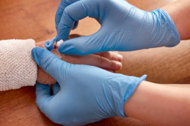Doktor kolundaki kateterden çocuğa ilaç enjekte etmek için pompa kullanıyor..