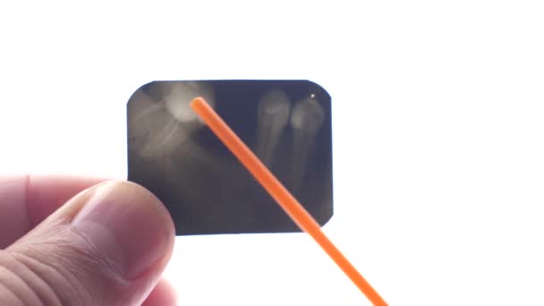 Röntgenbild Tänderna Studeras Tandvård Diagnostik Tandvård — Stockvideo