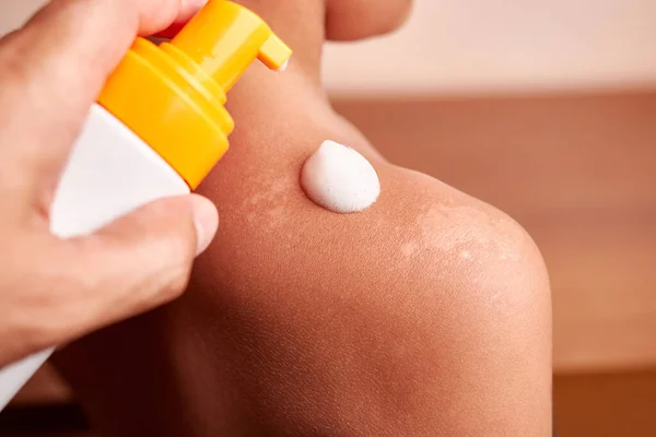 The foam is applied to sun-damaged areas of the skin. Sunburns on the skin. Body skin care. Protection against excessive sunburn and skin irritation.