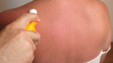 Köpük, cildin güneşten zarar görmüş bölgelerine uygulanır. Cildinde güneş yanıkları var. Vücut bakımı. Aşırı güneş yanığı ve cilt tahrişine karşı koruma.