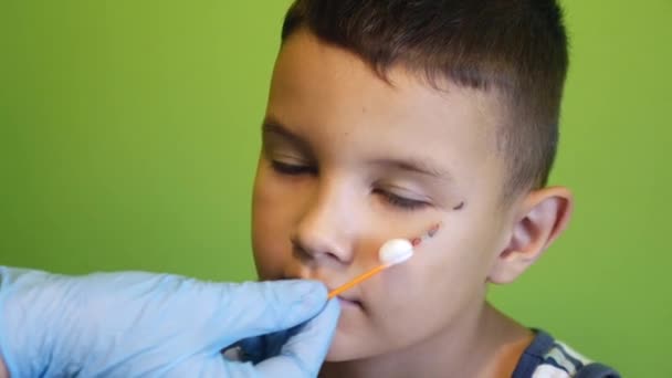 Såret Pojkens Ansikte Behandlas Med Pantenolskum Behandling Och Läkning Repor — Stockvideo