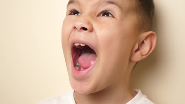 Lekarz Bada Jamę Ustną Dziecka Brakującym Zębem Koncepcja Opieki Zdrowotnej — Wideo stockowe