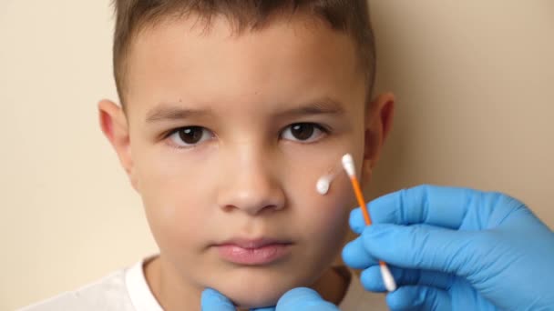 Cicatriz Cara Del Niño Trata Con Ungüento Tratamiento Cicatrices Pigmentación — Vídeo de stock