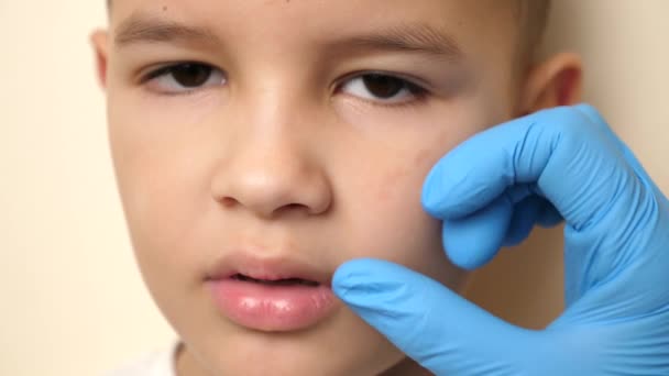 Bir Doktor Dişi Eksik Bir Çocuğun Ağız Boşluğunu Inceliyor Sağlık — Stok video