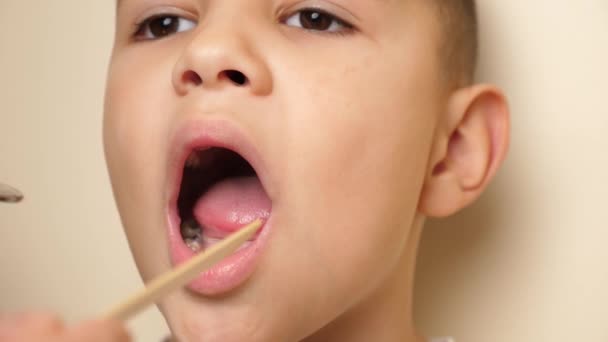 Γιατρός Εξετάζει Στοματική Κοιλότητα Ενός Παιδιού Ένα Δόντι Που Λείπει — Αρχείο Βίντεο
