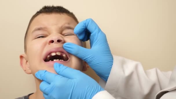 歯が欠けている少年の口腔を調べる — ストック動画
