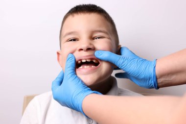 Bir doktor süt dişleri eksik bir çocuğun ağız boşluğunu inceliyor. Diş sağlığı ve diş bakımı.