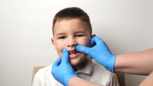 Onderzoek Van Mondholte Van Een Jongen Met Ontbrekende Melktanden Tandheelkunde — Stockvideo